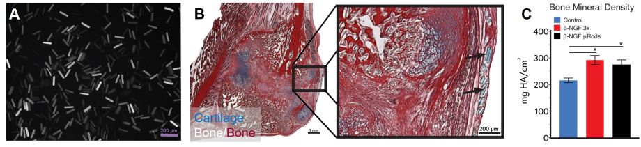 images and chart.