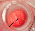 drug delivery device