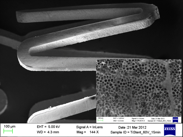 vascular stents diagram 1