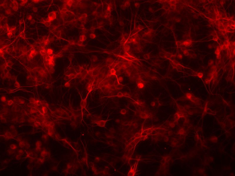 neurons