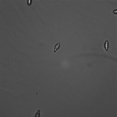 Schistosomula