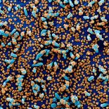 SARS-COV2 virus particles on human cells