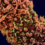 Human cells infected with SARS-CoV-2 virus
