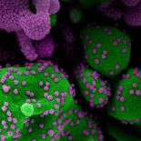 Human cells dotted with viral particles