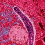 Malaria parasite