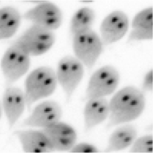 Giardia lamblia