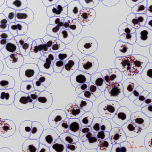 Leishmania