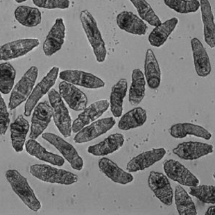 Schistosoma mansoni